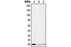 Western blot analysis of IL-2 expression in HEK293T (A), NIH3T3 (B), H9C2 (C) whole cell lysates. (IL-2 antibody  (Center))