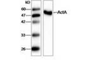 Image no. 1 for anti-Listeria Monocytogenes ActA (AA 117-278) antibody (ABIN791621) (Listeria Monocytogenes ActA (AA 117-278) antibody)