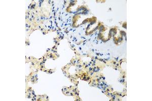 Immunohistochemistry of paraffin-embedded rat lung using LLGL2 antibody (ABIN5975836) at dilution of 1/200 (40x lens). (LLGL2 antibody)