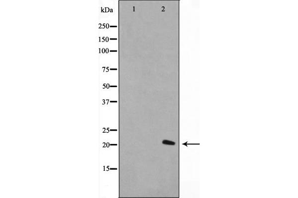 Histone H1 antibody  (Internal Region)