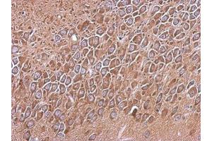IHC-P Image Immunohistochemical analysis of paraffin-embedded CL1-5 xenograft, using RP105, antibody at 1:500 dilution.
