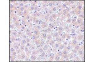 Immunohistochemistry of sRANK-L in human liver tissue with this product at 5 μg/ml. (RANKL antibody  (Center))