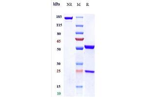 Anti-IL-18 Reference Antibody (GSK 1070806) on SDS-PAGE under reducing (R) condition.