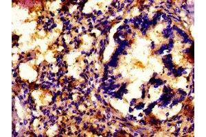 Immunohistochemistry (IHC) image for anti-ATPase, Cu++ Transporting, alpha Polypeptide (ATP7A) (AA 257-488) antibody (ABIN7148551)