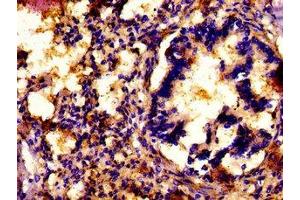 IHC image of ABIN7154307 diluted at 1: 500 and staining in paraffin-embedded human lung tissue performed on a Leica BondTM system. (ATP7A antibody  (AA 257-488))