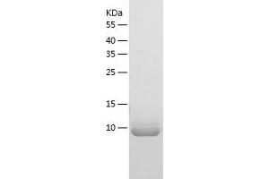 Western Blotting (WB) image for TP53 Regulated Inhibitor of Apoptosis 1 (TRIAP1) (AA 1-76) protein (His tag) (ABIN7284479) (TRIAP1 Protein (AA 1-76) (His tag))