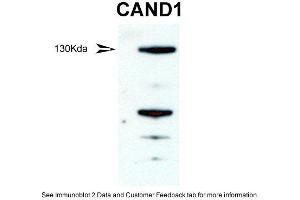 WB Suggested Anti-CAND1 Antibody  Titration: 1 ug/ml Positive Control: mouse testis (CAND1 antibody  (Middle Region))