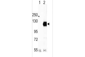 Western blot analysis of EphA2 (arrow) using rabbit polyclonal EphA2 Antibody (C-term) (ABIN391886 and ABIN2841706).