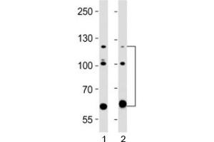 Western blot testing of ABL2 antibody at 1:2000 dilution.