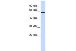 Image no. 1 for anti-serine Palmitoyltransferase, Long Chain Base Subunit 1 (SPTLC1) (AA 216-265) antibody (ABIN6740984) (SPTLC1 antibody  (AA 216-265))