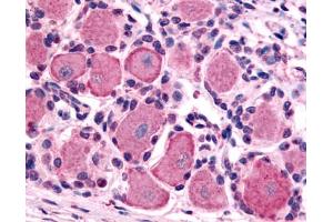 Anti-5HT1D Receptor antibody IHC of human spinal cord, dorsal root ganglion. (5HT1D antibody  (Cytoplasmic Domain))