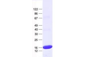 Chromosome 12 Open Reading Frame 76 (C12ORF76) protein (His tag)