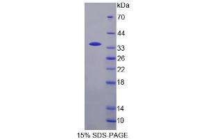 SDS-PAGE analysis of Human TCEA3 Protein. (TCEA3 Protein)