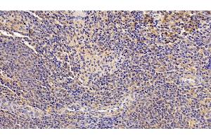 Detection of IL4R in Porcine Spleen Tissue using Polyclonal Antibody to Interleukin 4 Receptor (IL4R) (IL4 Receptor antibody  (AA 26-232))