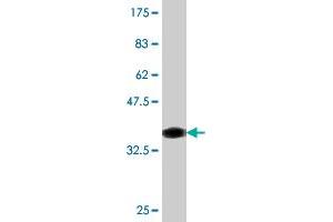 Western Blot detection against Immunogen (36. (ATRX antibody  (AA 2311-2410))