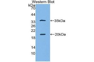 Western Blotting (WB) image for anti-serine Peptidase Inhibitor, Kazal Type 5 (SPINK5) (AA 699-976) antibody (ABIN1860613)