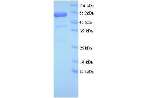SDS-PAGE (SDS) image for GRB10 Interacting GYF Protein 2 (GIGYF2) (AA 510-1030), (partial) protein (His tag) (ABIN5714390)