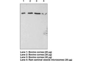 Image no. 1 for anti-Prostaglandin F Receptor (FP) (PTGFR) antibody (ABIN2450569) (PTGFR antibody)