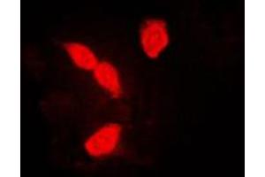 Immunofluorescent analysis of hnRNP A1 staining in K562 cells. (HNRNPA1 antibody  (Center))