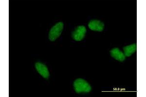 Immunofluorescence of purified MaxPab antibody to FHL3 on HeLa cell. (FHL3 antibody  (AA 1-280))