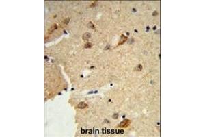 Formalin-fixed and paraffin-embedded human brain tissue reacted with DTX4 Antibody (N-term), which was peroxidase-conjugated to the secondary antibody, followed by DAB staining. (Deltex Homolog 4 antibody  (N-Term))