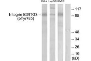 Western blot analysis of extracts from HeLa cells, HepG2 cells and HuvEc cells, using Integrin beta3 (Phospho-Tyr785) Antibody. (Integrin beta 3 antibody  (pTyr785))