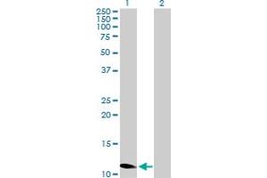 Western Blot analysis of ZNF695 expression in transfected 293T cell line by ZNF695 MaxPab polyclonal antibody. (ZNF695 antibody  (AA 1-133))