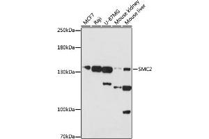 Western blot analysis of extracts of various cells, using SMC2 antibody (ABIN7270615) at 1:1000 dilution. (SMC2 antibody  (AA 700-900))