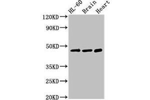 Western Blot Positive WB detected in: HL60 whole cell lysate, Mouse brain tissue, Rat heart tissue All lanes: CHST1 antibody at 3 μg/mL Secondary Goat polyclonal to rabbit IgG at 1/50000 dilution Predicted band size: 47 kDa Observed band size: 47 kDa (CHST1 antibody  (AA 305-397))