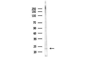 anti-RAB15, Member RAS Onocogene Family (RAB15) (Internal Region) antibody
