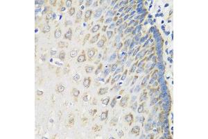 Immunohistochemistry of paraffin-embedded human esophagus using MSRB2 antibody at dilution of 1:100 (40x lens).