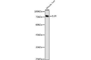 Western blot analysis of extracts of Mouse liver, using IL6R antibody (ABIN3015521, ABIN3015522, ABIN3015523, ABIN1680455 and ABIN6218635) at 1:1000 dilution. (IL-6 Receptor antibody  (AA 20-320))