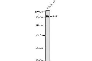 Western blot analysis of extracts of Mouse liver, using IL6R antibody (ABIN3015521, ABIN3015522, ABIN3015523, ABIN1680455 and ABIN6218635) at 1:1000 dilution.