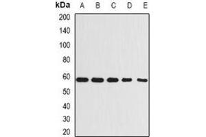 Western blot analysis of Beclin-1 expression in A431 (A), MCF7 (B), Raji (C), mouse kidney (D), rat brain (E) whole cell lysates. (Beclin 1 antibody)