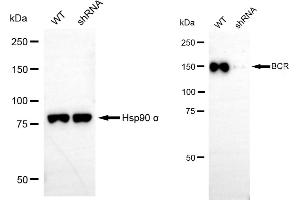 Western blotting analysis using BCR antibody (ABIN7797789). (Recombinant BCR antibody)