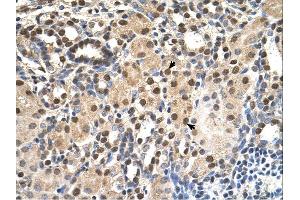 Immunohistochemistry (IHC) image for anti-Acidic (Leucine-Rich) Nuclear phosphoprotein 32 Family, Member E (ANP32E) (Middle Region) antibody (ABIN310810) (ANP32E antibody  (Middle Region))