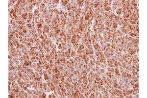 IHC-P Image Immunohistochemical analysis of paraffin-embedded MDA-MB468 xenograft, using BMP4, antibody at 1:100 dilution.