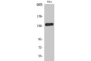 Western Blot (WB) analysis of HeLa cells using E-cadherin Polyclonal Antibody. (E-cadherin antibody  (C-Term))