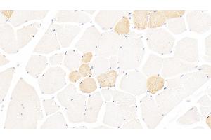 Detection of MYH1 in Human Skeletal muscle Tissue using Polyclonal Antibody to Myosin Heavy Chain 1 (MYH1) (MYH1 antibody  (AA 585-794))