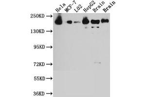 Western Blot Positive WB detected in: Hela whole cell lysate, MCF-7 whole cell lysate, L02 whole cell lysate, HepG2 whole cell lysate, Mouse Brain whole cell lysate, Rat Brain whole cell lysate All lanes: ROCK2 antibody at 1:1000 Secondary Goat polyclonal to rabbit IgG at 1/50000 dilution Predicted band size: 161 kDa Observed band size: 161 kDa (Recombinant ROCK2 antibody)