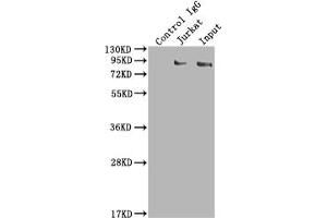Immunoprecipitating SUZ12 in K562 whole cell lysate Lane 1: Rabbit control IgG instead of ABIN7127832 in K562 whole cell lysate. (Recombinant SUZ12 antibody)