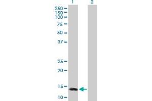 Western Blot analysis of MTTP expression in transfected 293T cell line by MTTP MaxPab polyclonal antibody. (MTTP antibody  (AA 1-151))