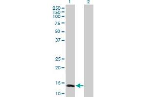 Western Blot analysis of MTTP expression in transfected 293T cell line by MTTP MaxPab polyclonal antibody.