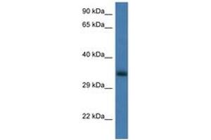Image no. 1 for anti-Glucosamine-6-Phosphate Deaminase 1 (GNPDA1) (AA 50-99) antibody (ABIN6747378) (GNPDA1 antibody  (AA 50-99))