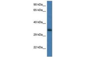 Image no. 1 for anti-Glucosamine-6-Phosphate Deaminase 1 (GNPDA1) (AA 50-99) antibody (ABIN6747378)