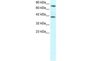Western Blotting (WB) image for anti-Zinc Finger Protein 652 (ZNF652) antibody (ABIN2460271)