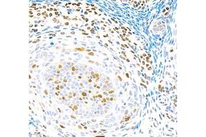 Immunohistochemistry (Paraffin-embedded Sections) (IHC (p)) image for anti-Topoisomerase (DNA) II alpha 170kDa (TOP2A) antibody (ABIN7075937)