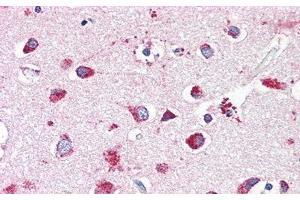 Immunohistochemistry (IHC) image for anti-Hexosaminidase B (Beta Polypeptide) (HEXB) (AA 294-435) antibody (ABIN7438139)