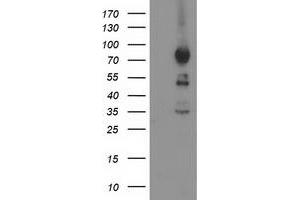 HEK293T cells were transfected with the pCMV6-ENTRY control (Left lane) or pCMV6-ENTRY ASCC2 (Right lane) cDNA for 48 hrs and lysed. (ASCC2 antibody)