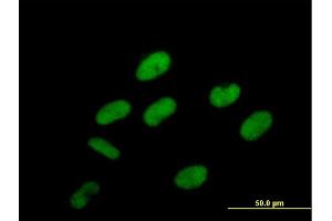 Immunofluorescence of purified MaxPab antibody to C20orf67 on HeLa cell. (PCIF1 antibody  (AA 1-704))